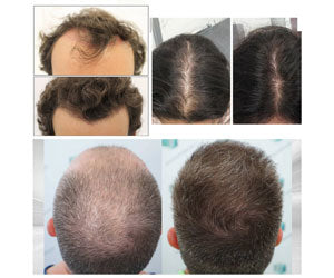 Hair Care Food Supplement 2x1 a 59,99€